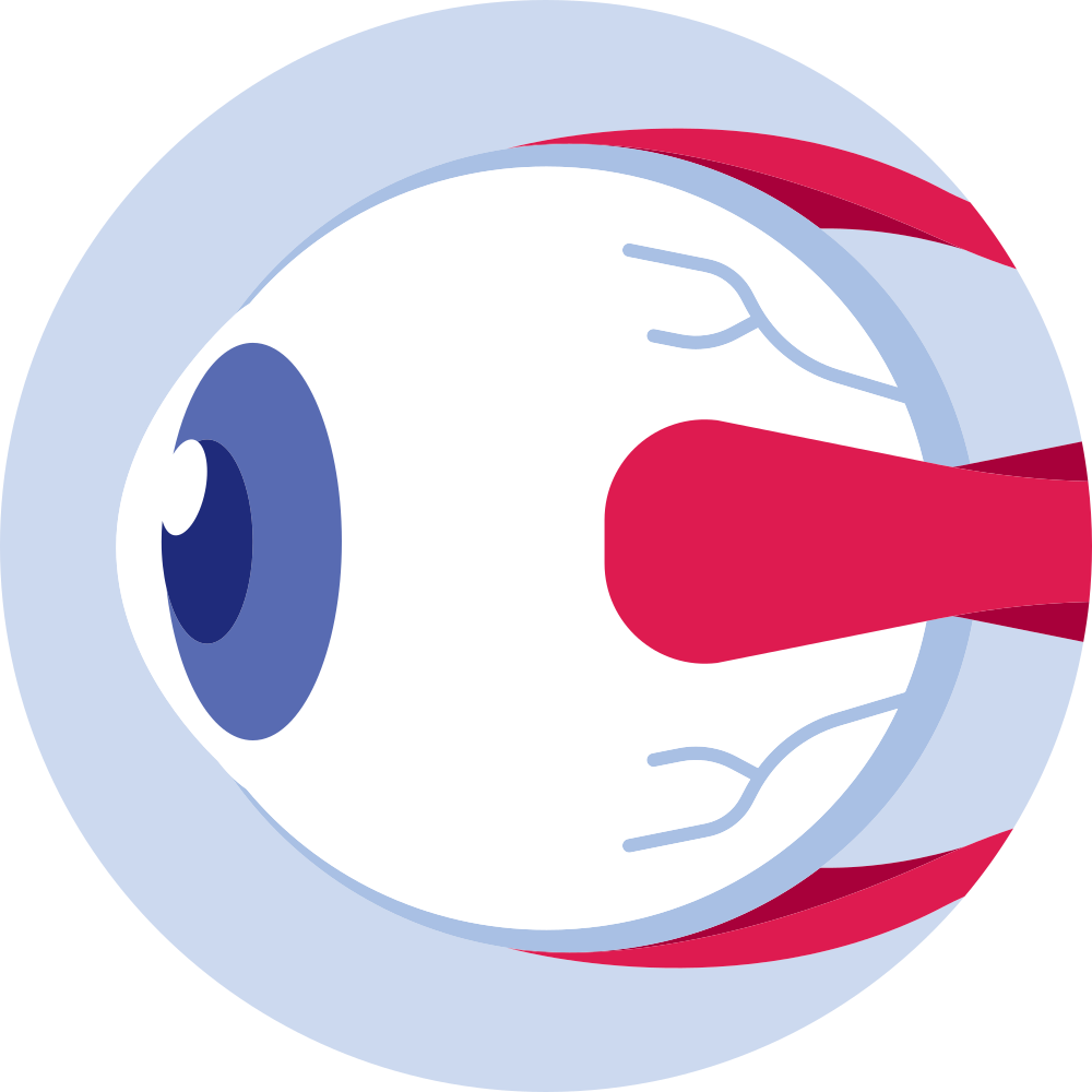 Sp. Mataicon